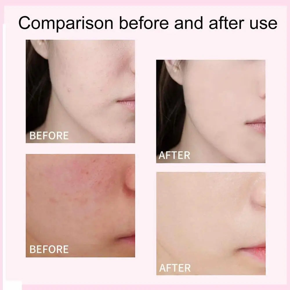 Sun Protection Sunscreen- SPF 50+