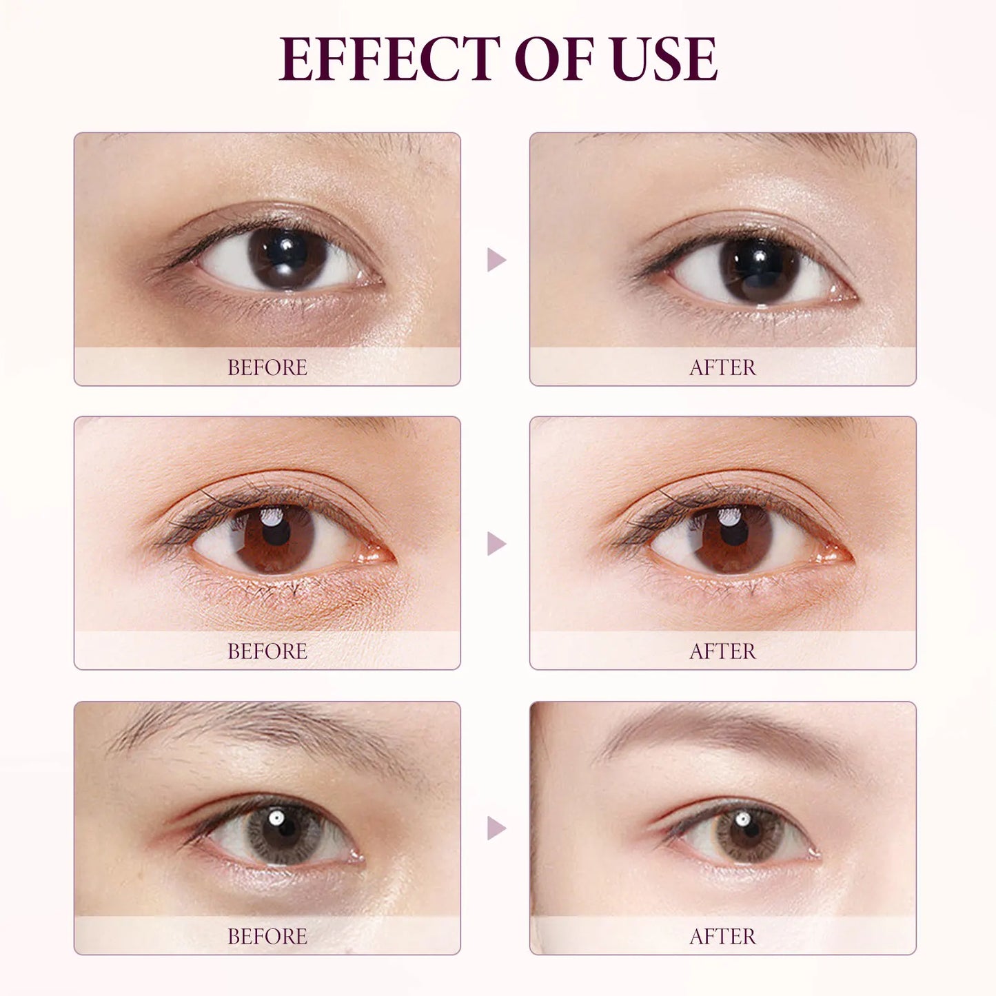 Anti Dark Circle Eye Cream